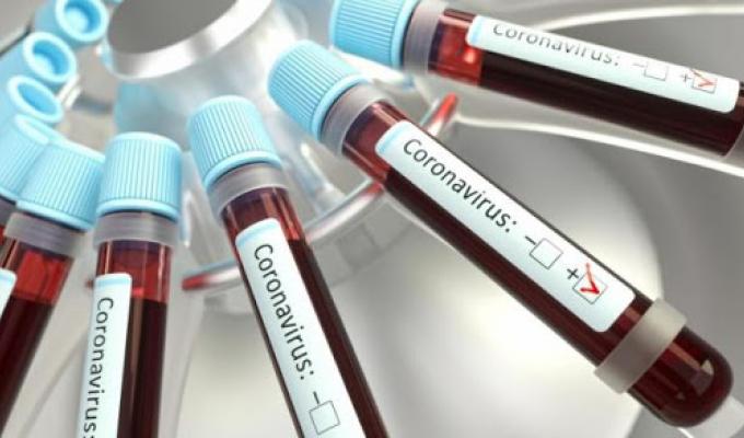 ПРО РЕЗУЛЬТАТИ  ДІАГНОСТУВАННЯ НАСЕЛЕННЯ РАЙОНУ НА COVID-19