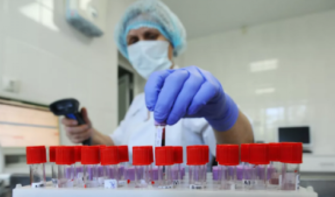 Епідеміологічна ситуація щодо захворюваності на COVID-19 в Новопсковському районі не поліпшується: підтверджено два нових випадки