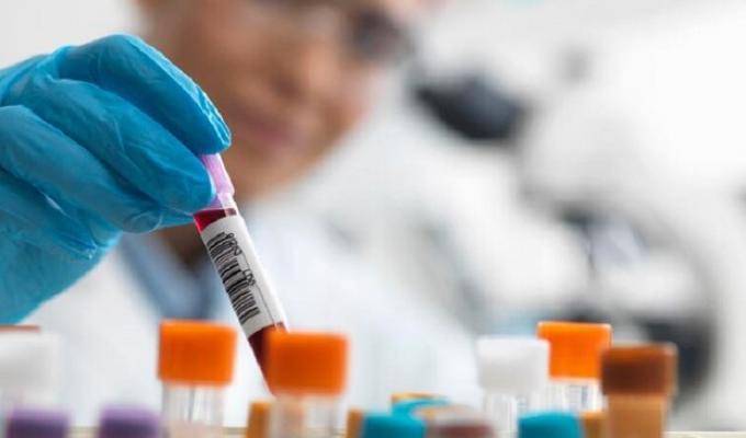 Інформуємо про стан захворюваності населення на інфекційні хвороби