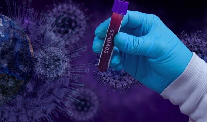 Лабораторно підтверджено 101 новий випадок COVID-19 в області