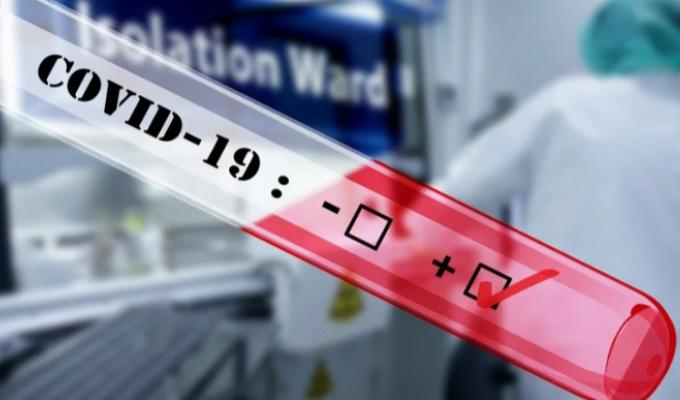 ВИЯВЛЕНО 13 НОВИХ ВИПАДКІВ ЗАХВОРЮВАННЯ НА COVID-19