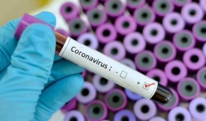 Лабораторно підтверджено 161 новий випадок COVID-19 в області