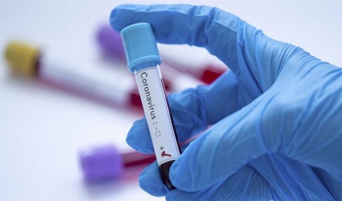 Лабораторно підтверджено 43 нових випадки COVID-19 в області