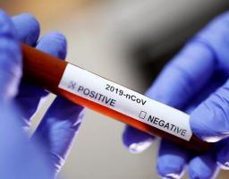 Лабораторно підтверджено 17 нових випадків COVID-19 в області