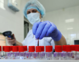 Епідеміологічна ситуація щодо захворюваності на COVID-19 в Новопсковському районі не поліпшується: підтверджено два нових випадки