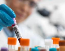 Інформуємо про стан захворюваності населення на інфекційні хвороби