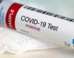 Протягом вихідних кількість захворілих на COVID-19 збільшилась на 6 осіб