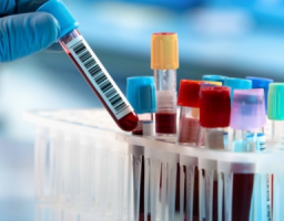 На Луганщині лабораторно підтверджено 55 нових випадків COVID-19
