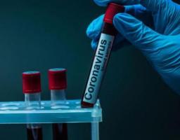Лабораторно підтверджено 26 нових випадків COVID-19 в області. Від ускладнень померли ще чотири людини