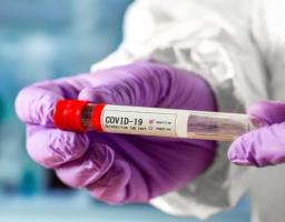 ПРО ЗМІНИ У ТЕСТУВАННІ НА COVID-19 НА ПЕРВИННІЙ ЛАНЦІ МЕДИЧНОЇ ДОПОМОГИ