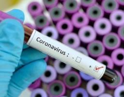 Лабораторно підтверджено 213 нових випадків COVID-19 в області. Від ускладнень померло чотири людини. В Україні – 407